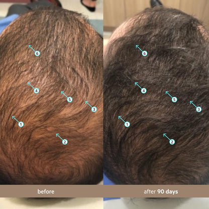 Spectral para Hombre (Spectral.DNC-N) | Suero de Densidad Capilar con Nanoxidil al 5%